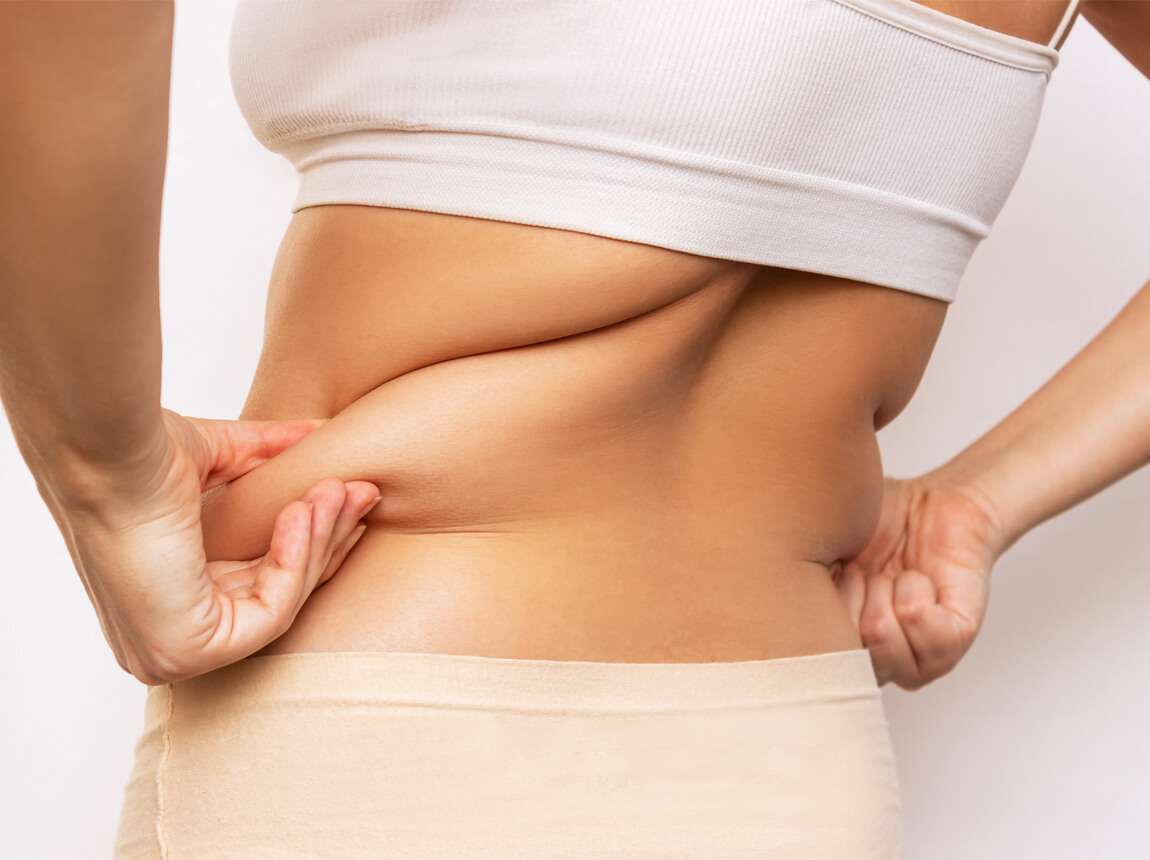 femei - flancuri, grăsime abdominală 