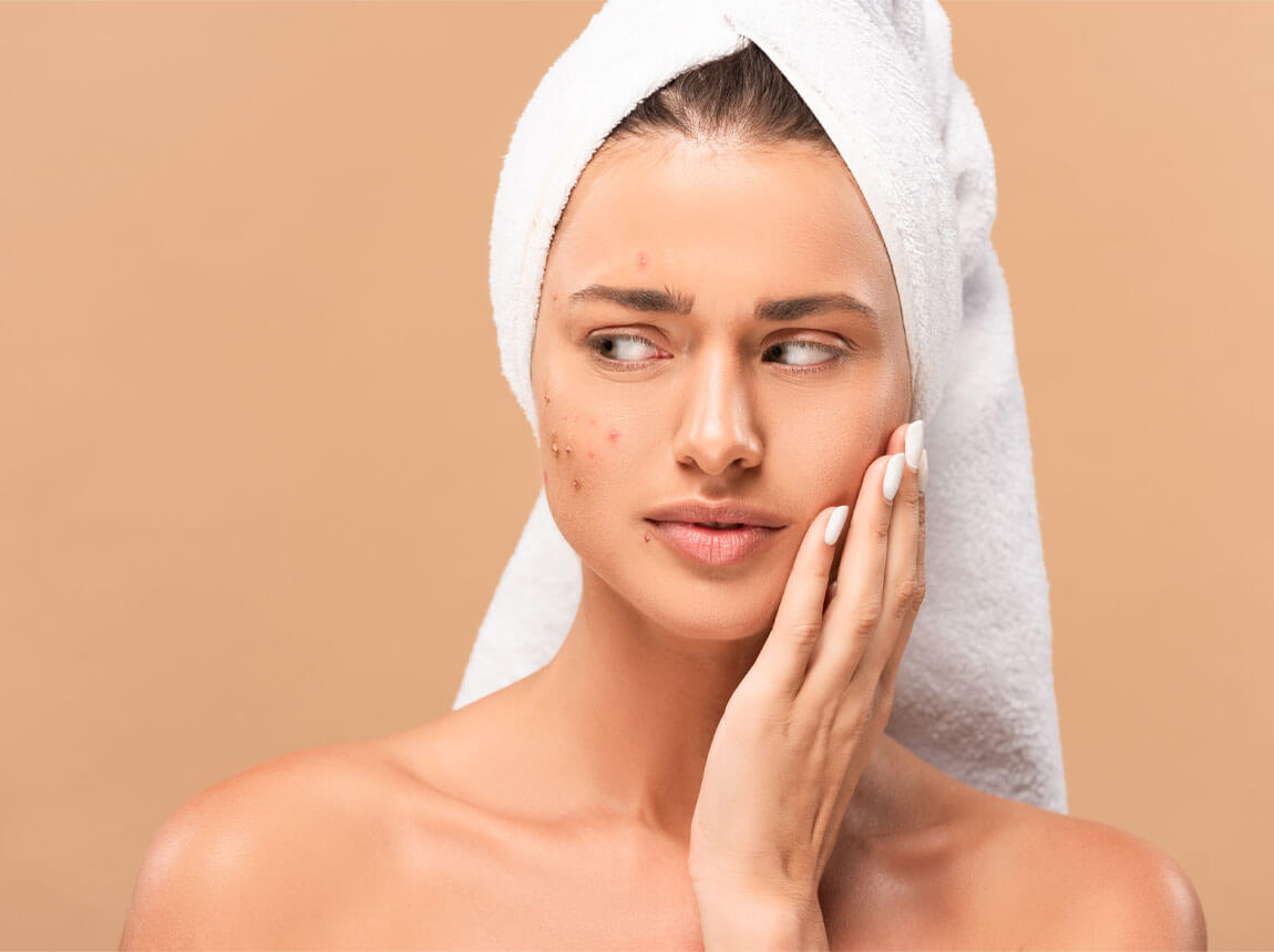 acnee facial feminine 