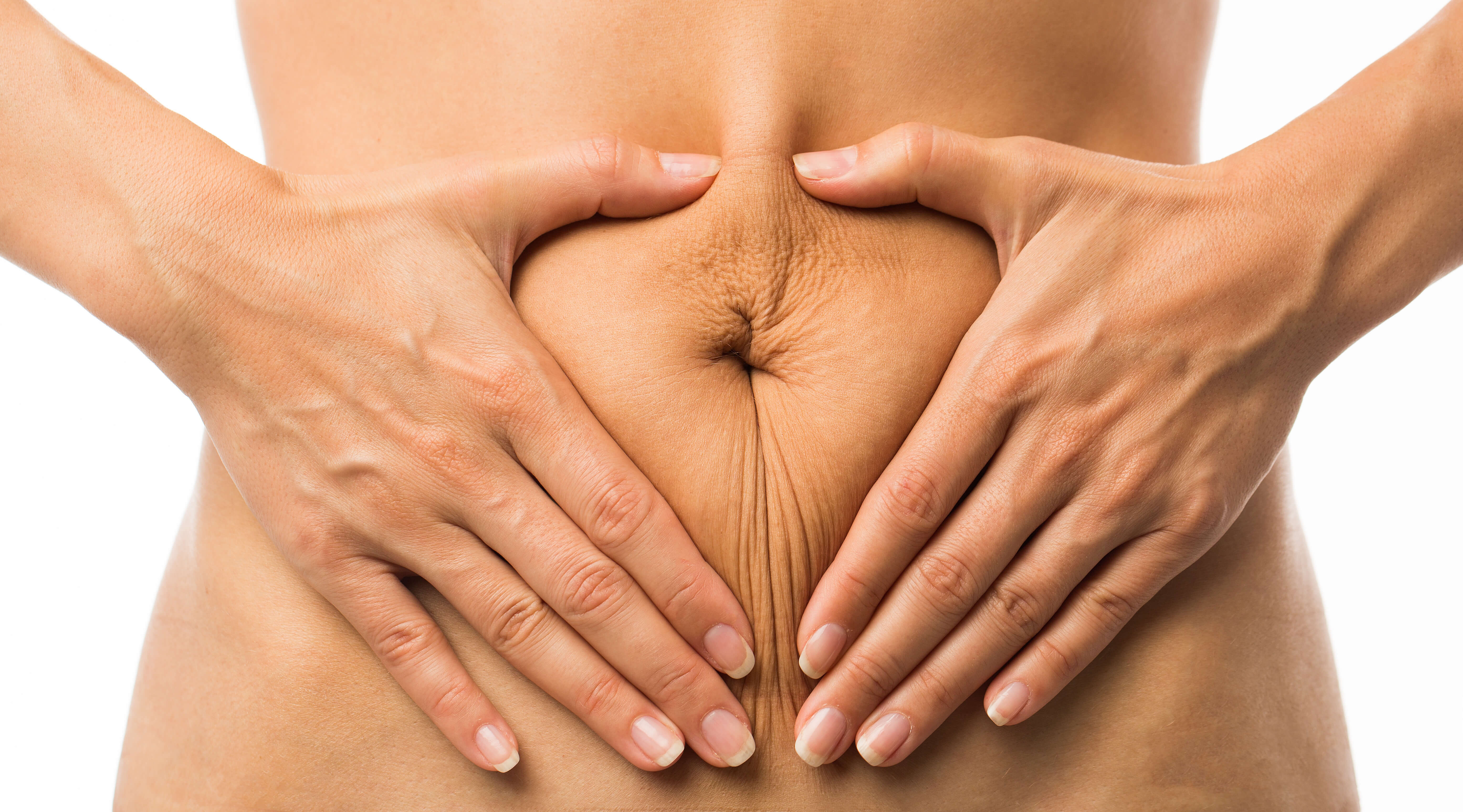 exces de piele pe abdomen 