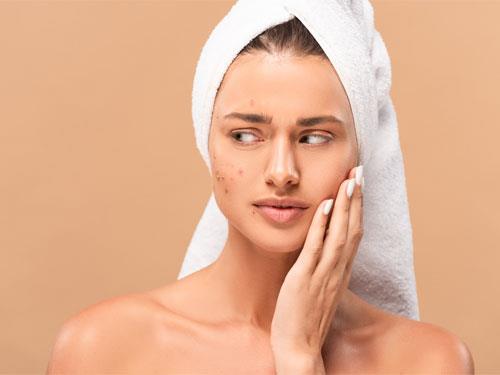 Este zincul bun pentru acne?